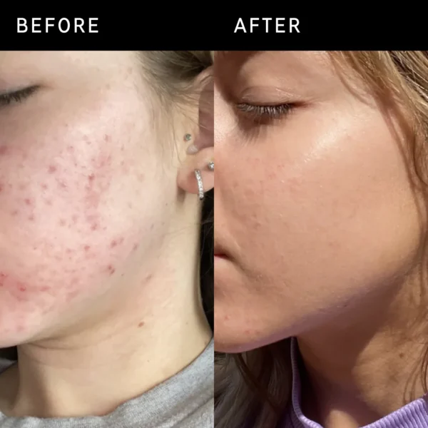 THE INKEY LIST- NIACINAMIDE SERUM 30 ML - Image 2