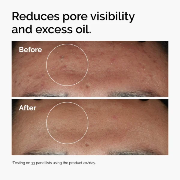THE ORDINARY NIACINAMIDE 10% + ZINC 1% 60ML - Image 3