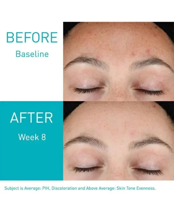CERAVE RETINOL SERUM - FOR POST ACNE MARKS AND SKIN TEXTURE - Image 3